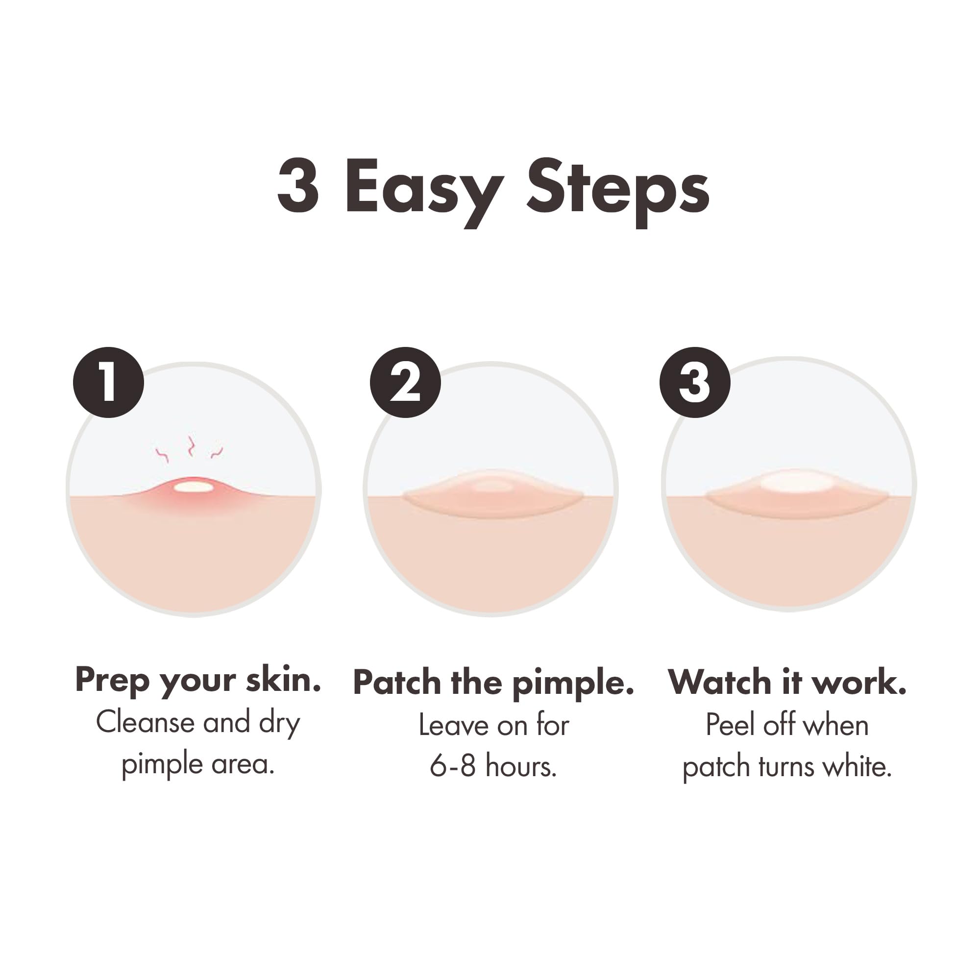 Hero Mighty Patch Day & Night, Hydrocolloid Pimple Patches (24 Pack)